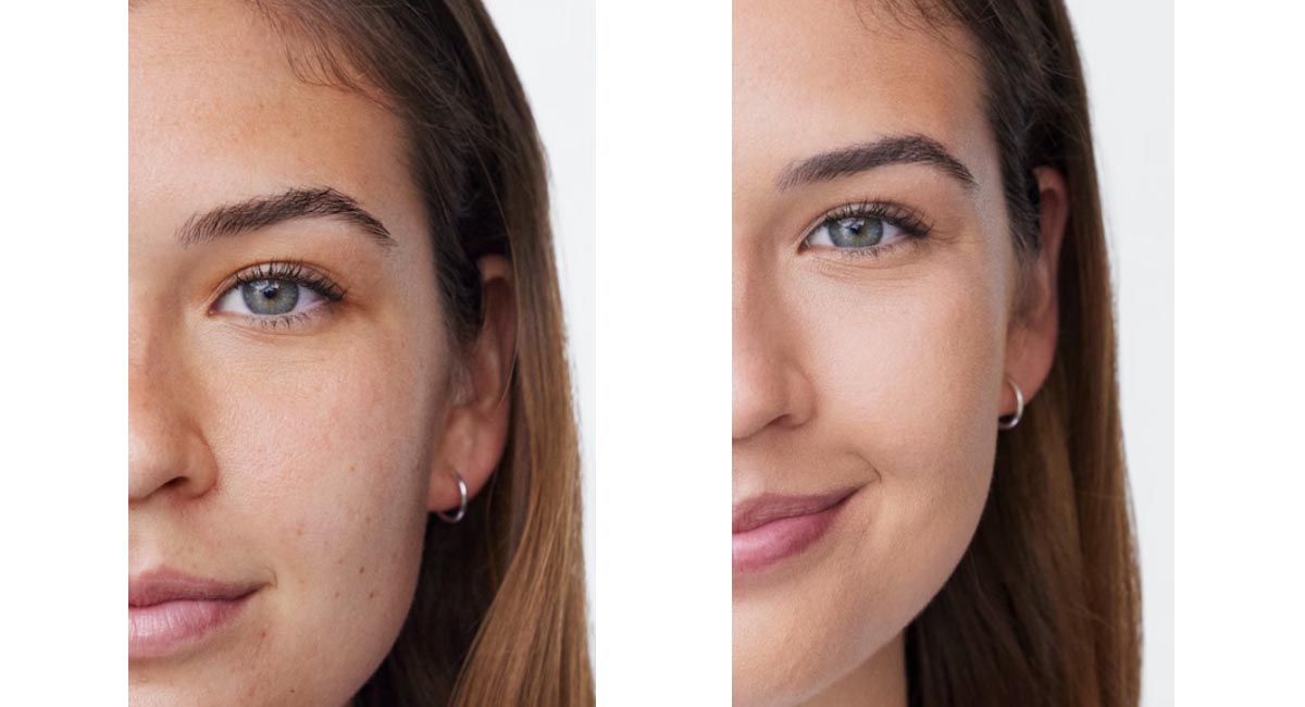 نظر متخصصان درباره نوآوری در کرم های ضد لک