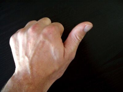 نشانه خطرناک لرزش انگشت شست