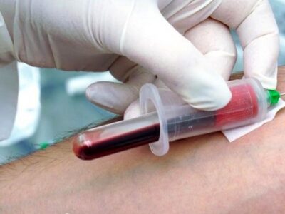 انجام  آزمایش خون چقدر آب میخورد؟ / قیمت چکاپ کامل بدن سال ۱۴۰۲