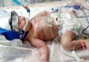 فوت تاسف برانگیز جنجالی نوزاد در بیمارستان نهاوند