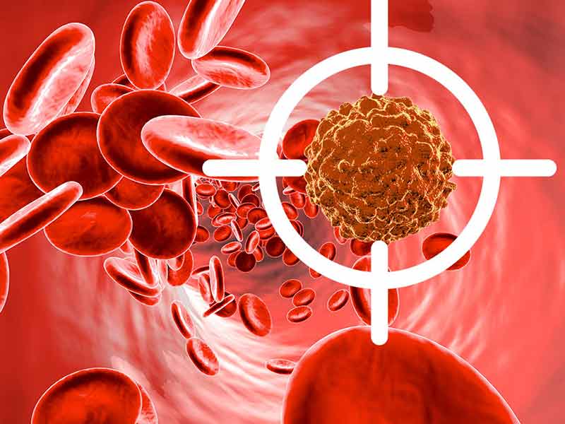 چه عواملی باعث ایجاد سرطان خون می شود ؟