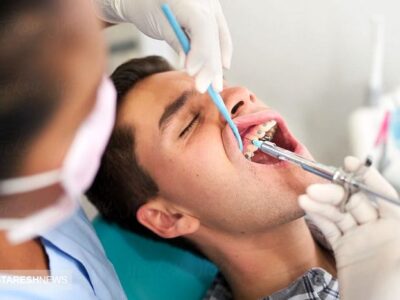 اعتراض یک نماینده به وزیر بهداشت / مردم توان مالی رفتن به دندانپزشکی را ندارند
