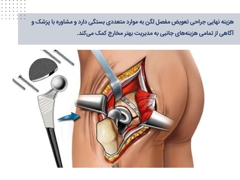 هزینه‌های اضافی جراحی تعویض مفصل لگن