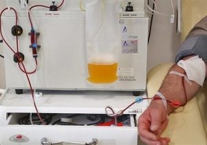 دستگاه پلاسمافِرزیس در خراسان شمالی/پایان اعزام بیماران و جهش در درمان بیماری‌های حاد خونی