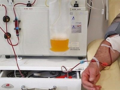 دستگاه پلاسمافِرزیس در خراسان شمالی/پایان اعزام بیماران و جهش در درمان بیماریهای حاد خونی