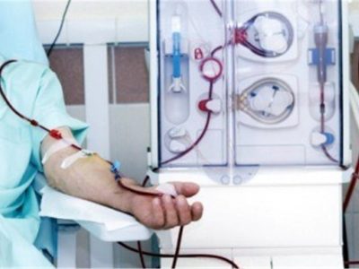 پرتودهی هسته‌ای ۱٫۳ میلیون فیلتر دیالیز بدون هیچ‌گونه عارضه