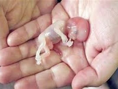 صدور کیفرخواست برای ۹ متهم پرونده سقط جنین غیرقانونی در گلستان