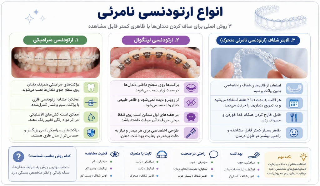 راهنمایی جامع ارتودنسی نامرئی انواع ارتودنسی نامرئی