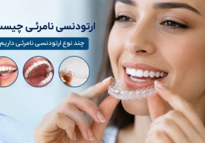 راهنمایی جامع ارتودنسی نامرئی