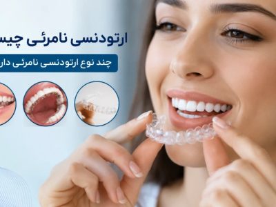 راهنمایی جامع ارتودنسی نامرئی